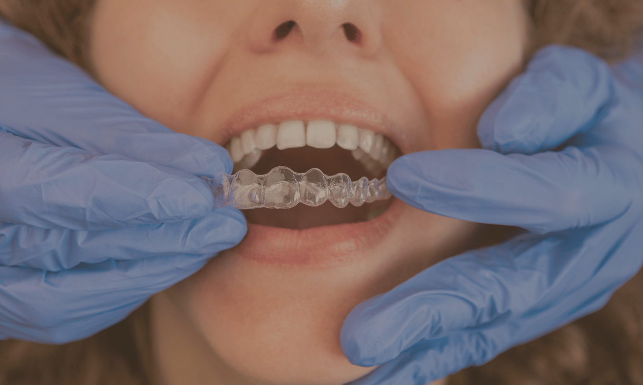 Will Invisalign Hurt or Be Noticeable? Busting the Two Biggest Myths