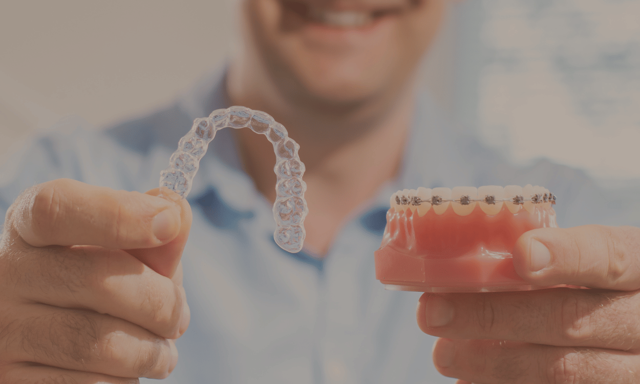Can Invisalign Fix Any Bite Issue? What It Can (and Can't) Treat