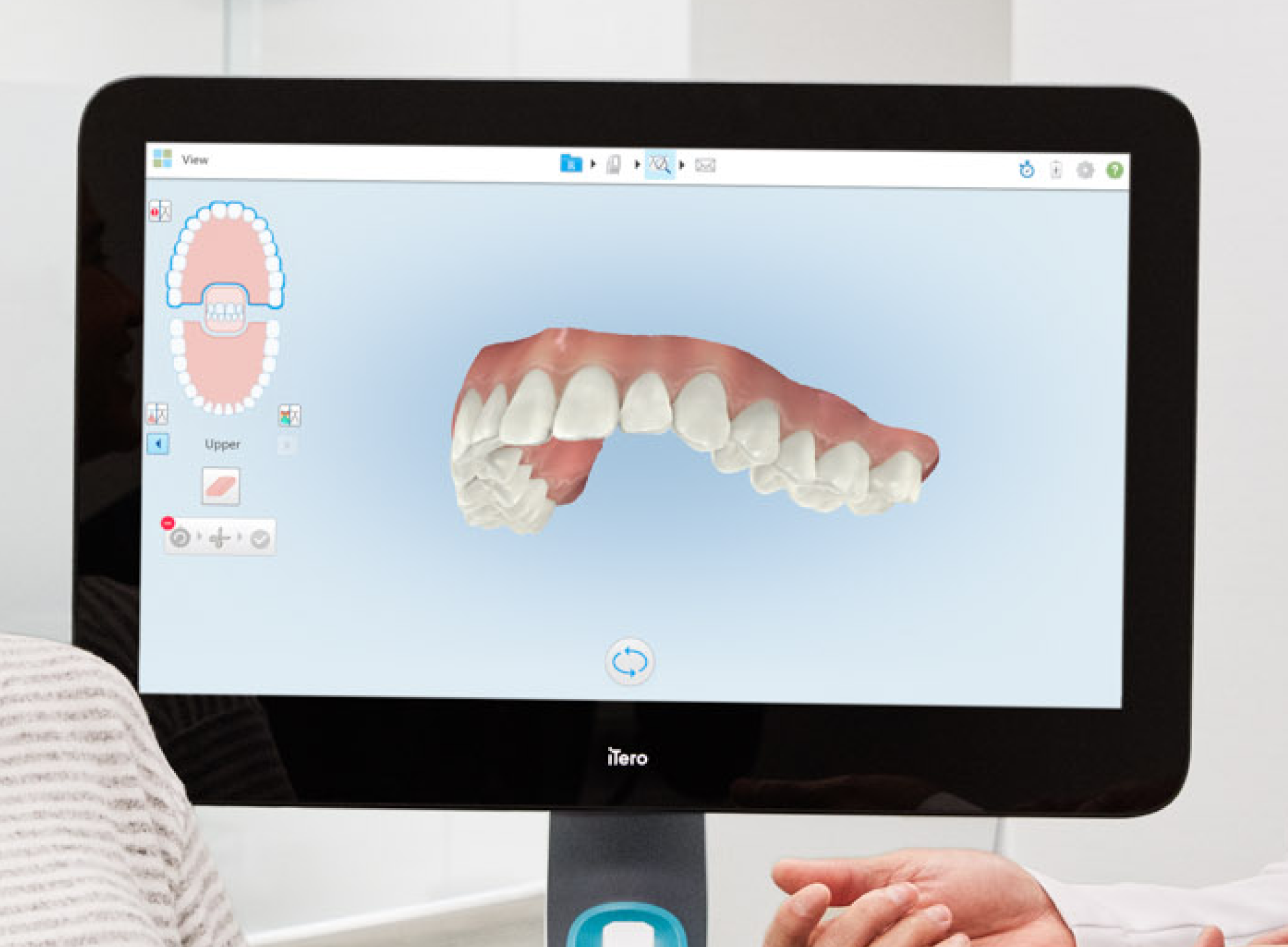 Digital display showing a 3D model of a set of upper teeth with gums on a dental scan screen.