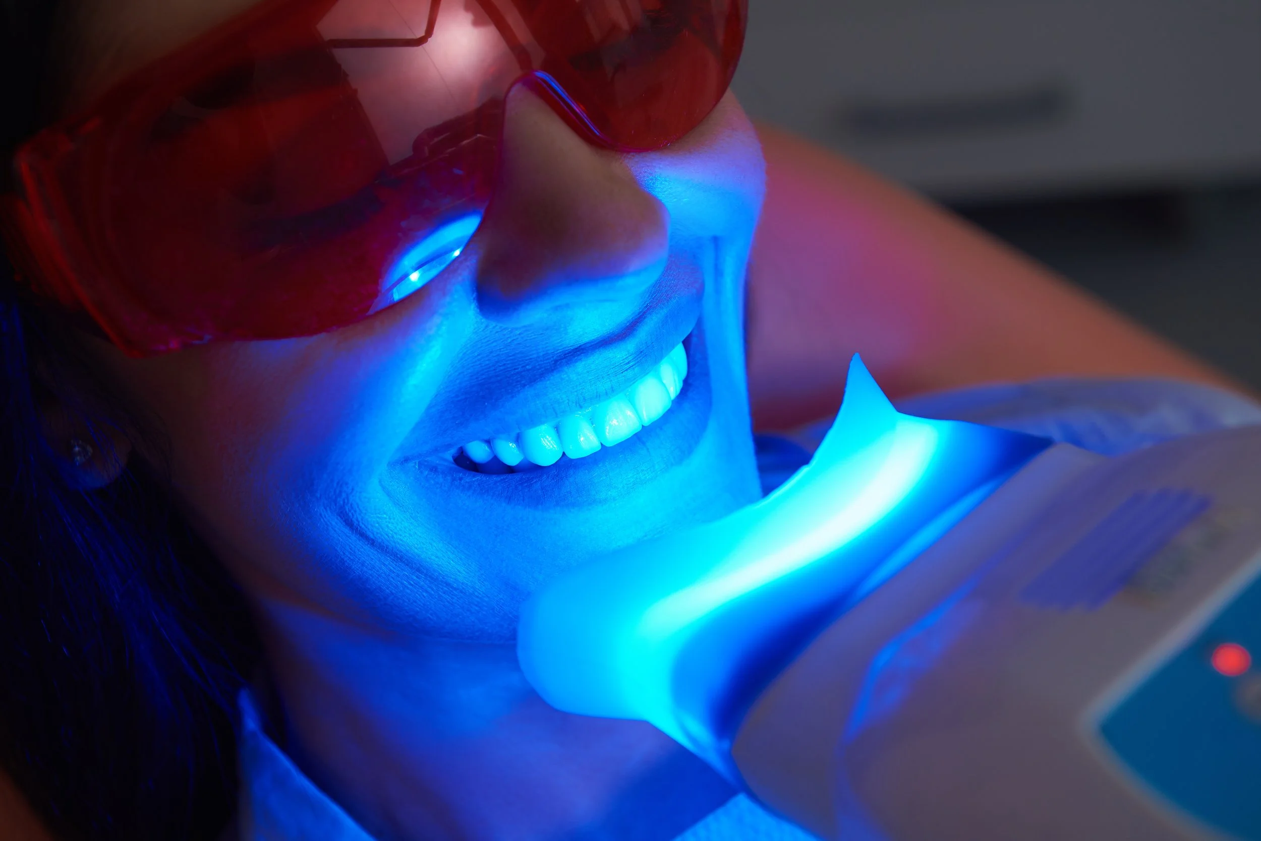 A woman wearing red protective glasses is smiling while undergoing a dental procedure under blue curing light.