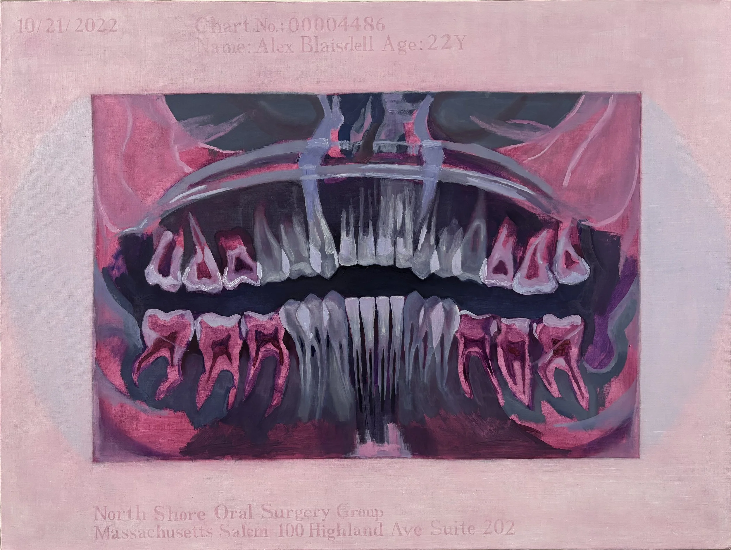 "Teeth" - Alex Blaisdell