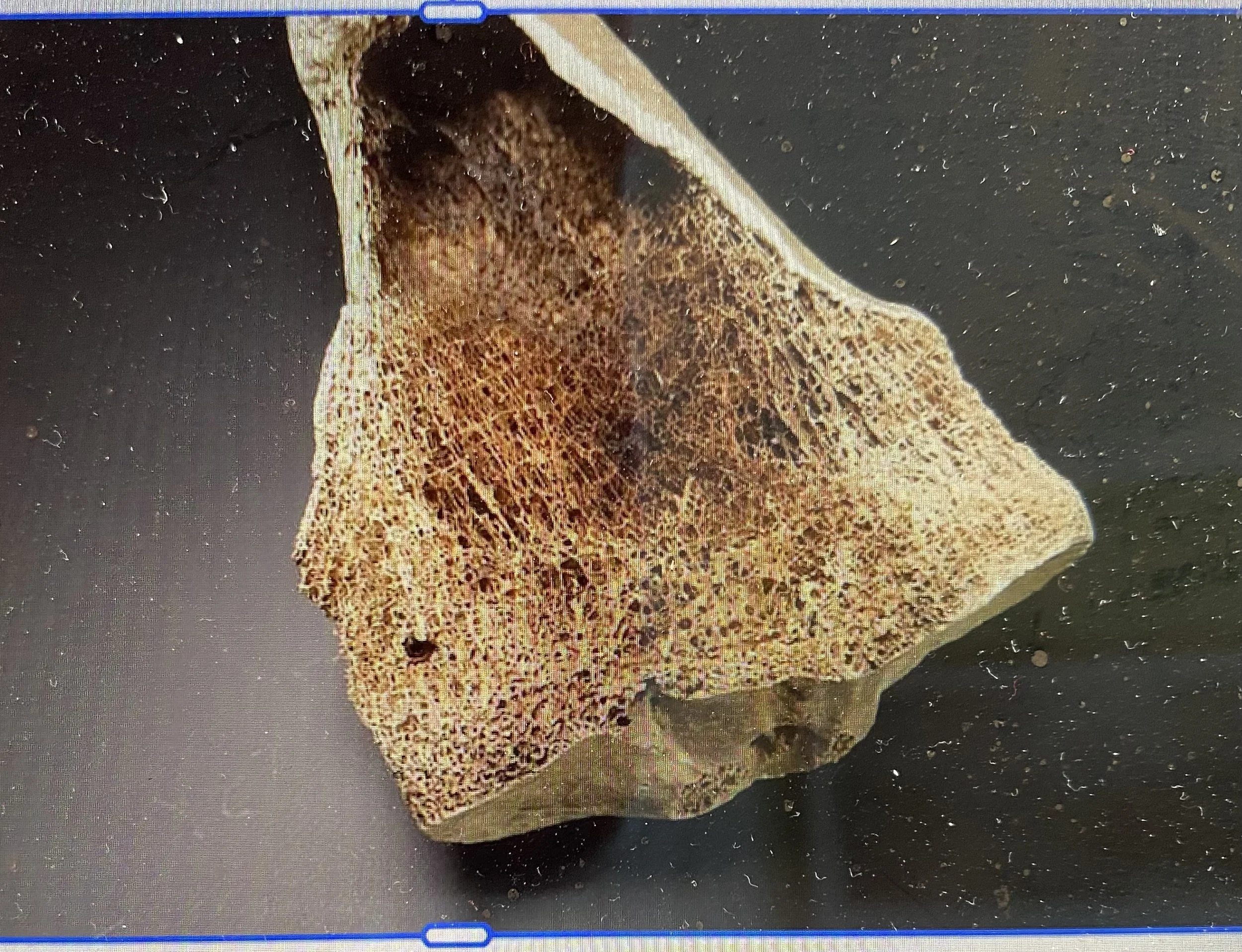 Bone Health and Menopause</span>