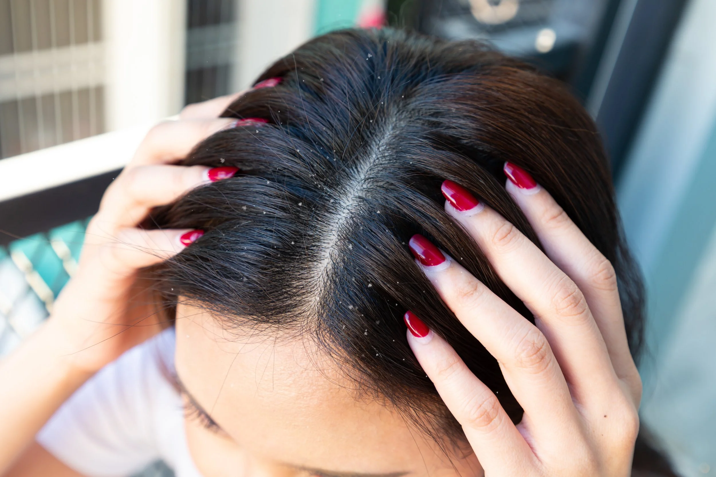 A woman parting her dark hair with her fingers to check her scalp for flaking.