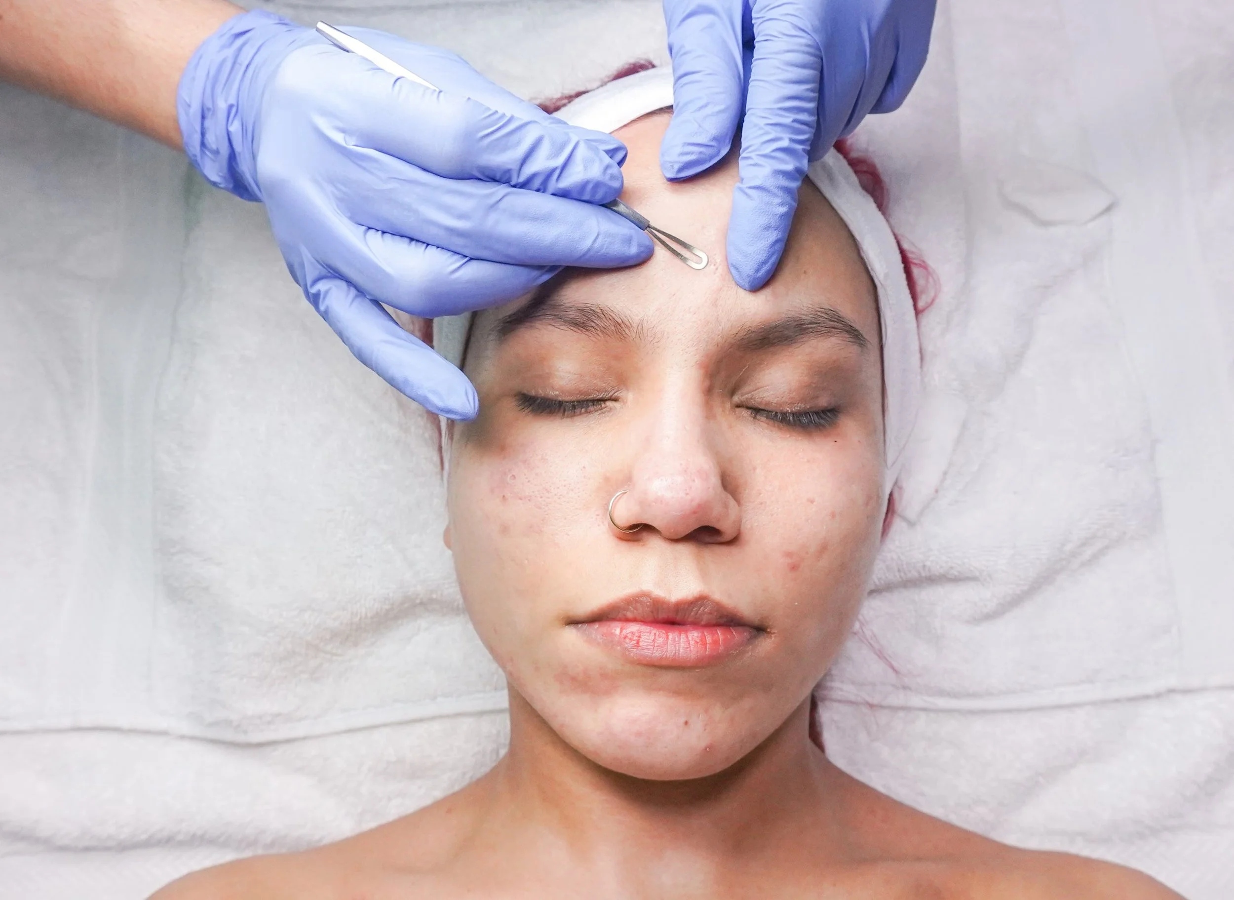 Licensed esthetician performing a dermaplaning treatment with a surgical blade to gently exfoliate the skin and remove peach fuzz, illustrating how dermaplaning works for smoother, brighter skin.