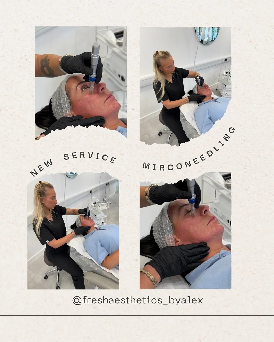 🚨 New service alert 🚨
Get booked in to achieve your dream skin🫧
#edinburgh #mirconeedling #skincare