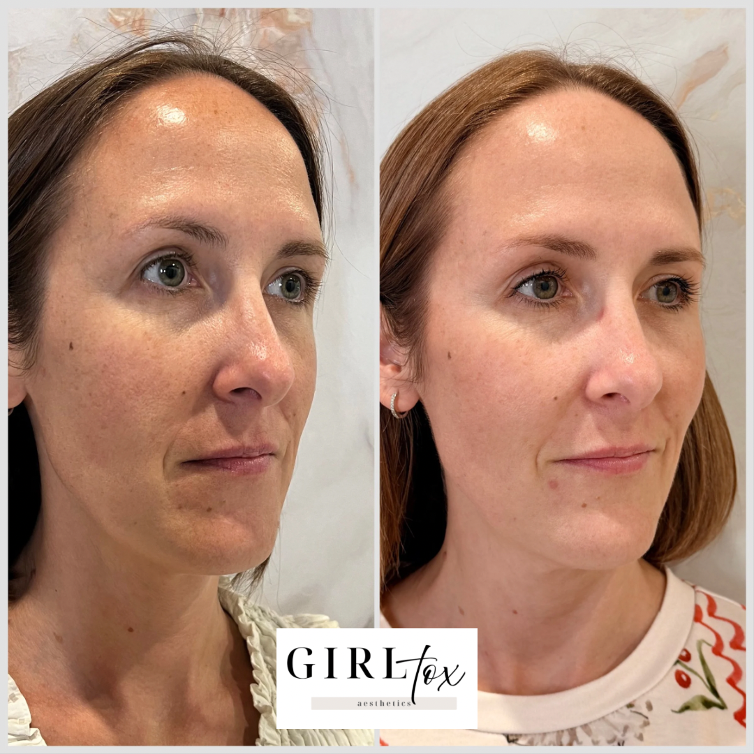 Untitled design - 4.png