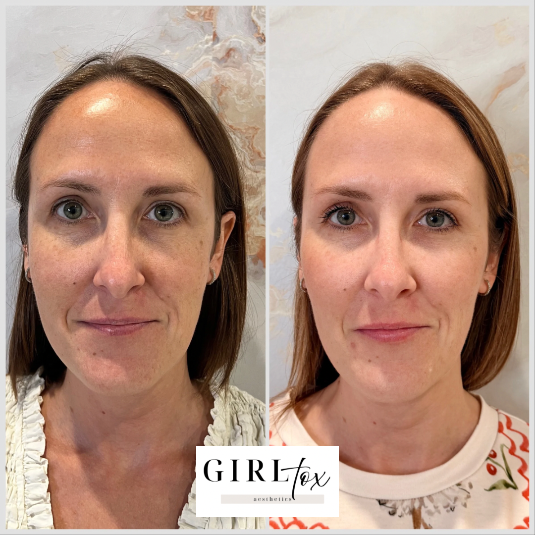 Untitled design - 3.png