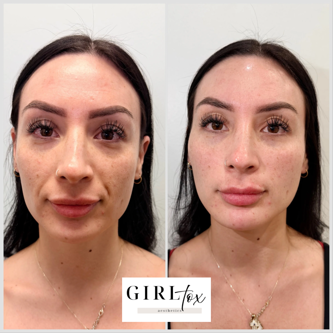 Untitled design - 2.png