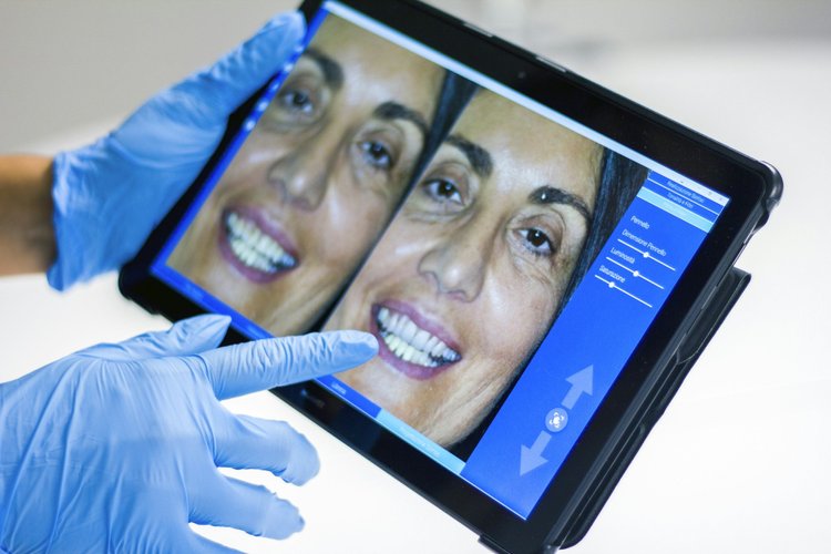 Dental professional reviewing smile photographs on a tablet