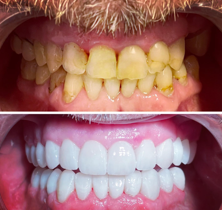 General 5 | Dental Clinic in Cairo | Veneers, Implants & Hollywood Smile