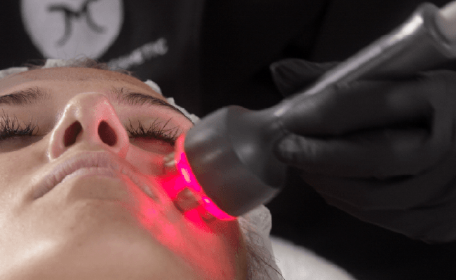 Ein Mensch erhält eine Behandlung mit einem roten Lasergerät im Gesicht, vermutlich bei einer kosmetischen oder dermatologischen Behandlung.