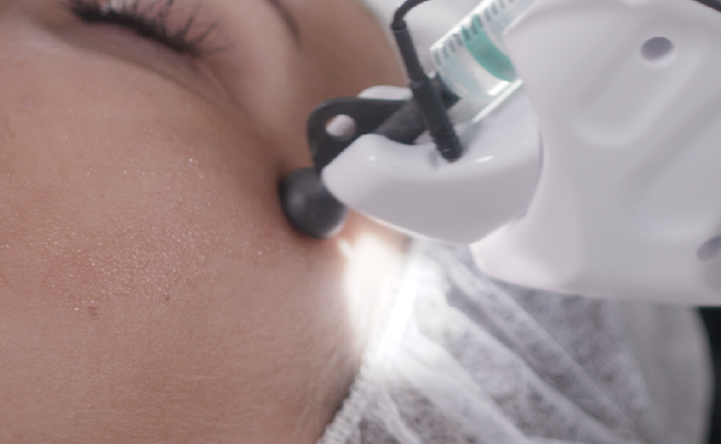 Nahaufnahme eines medizinischen Eingriffs mit einer Nase, bei dem eine medizinische Sonde oder ein Instrument verwendet wird.