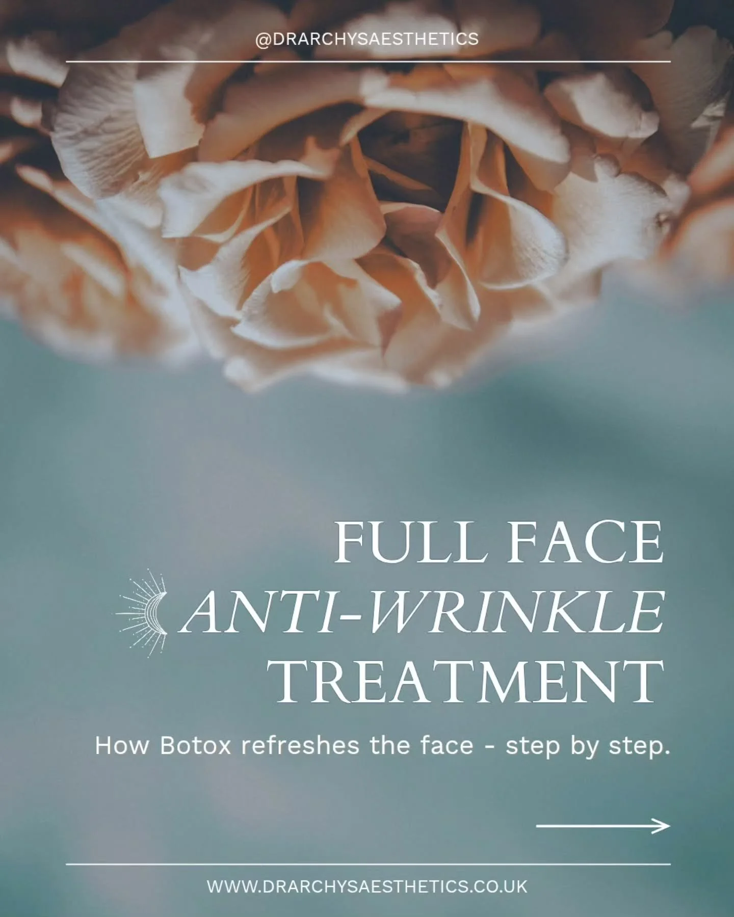 Full-face anti-wrinkle treatment isn&rsquo;t about freezing your expression - it&rsquo;s about softening tension, brightening the eyes and creating a naturally refreshed look that still feels like you.

This step-by-step approach works across:
✔ Fore