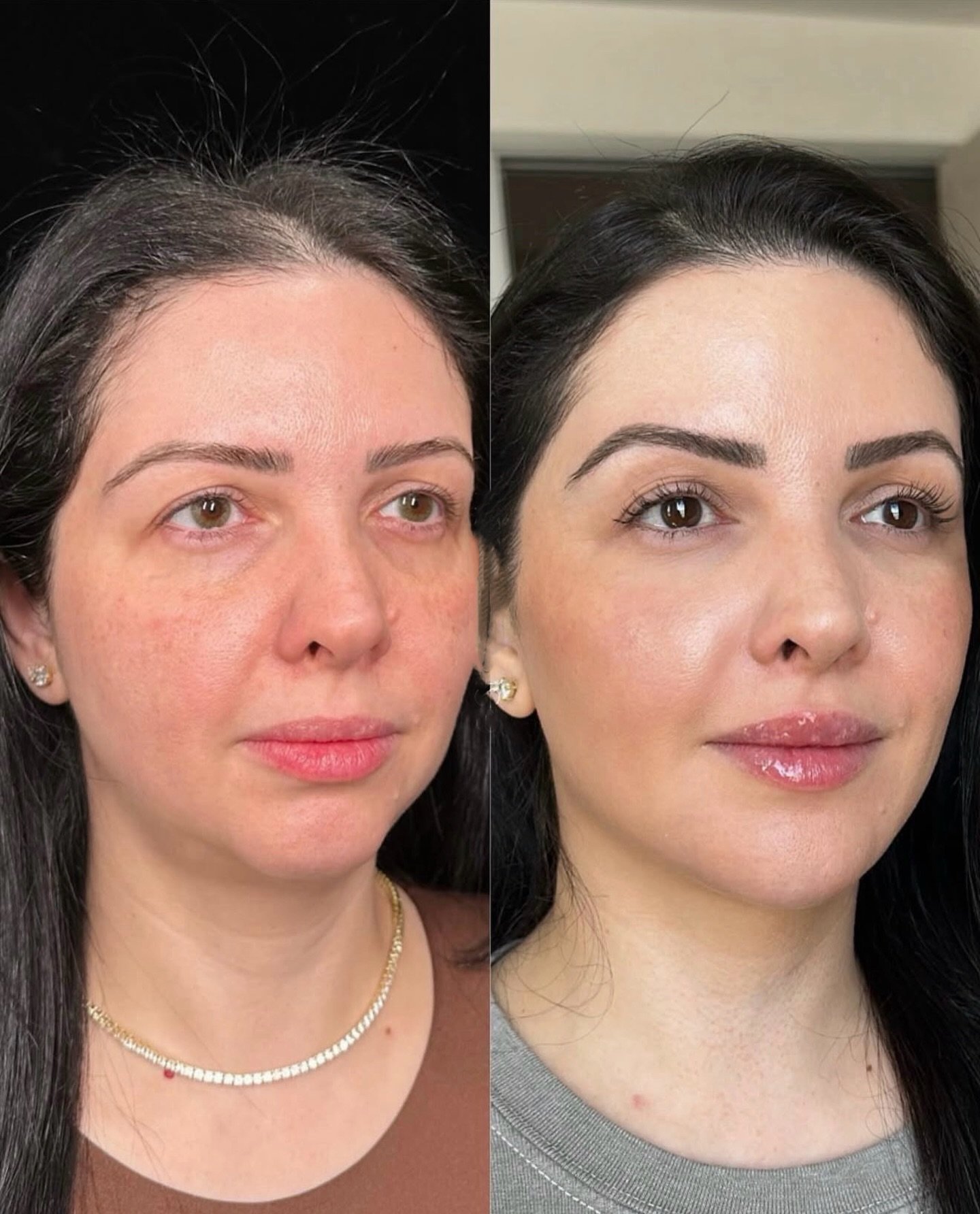 ✨ At Dr Archys Aesthetics, skin treatments are never about vanity &mdash; they&rsquo;re about balance, harmony, and enhancing the beauty that is already yours.

True radiance comes from feeling happy, wholesome, and confident in your own skin. When y