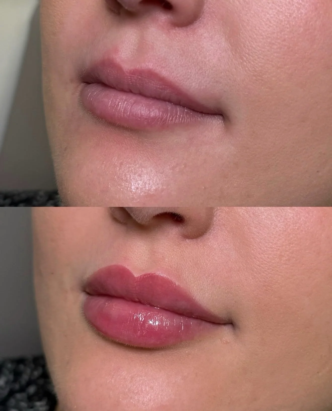 Heart-Shaped Lips 💋❤️

Heart-shaped lips are all about creating a soft, defined Cupid&rsquo;s bow with fuller volume in the center of the lips. The goal is a balanced, feminine look that feels naturally plump and elegant rather than overdone.

This 