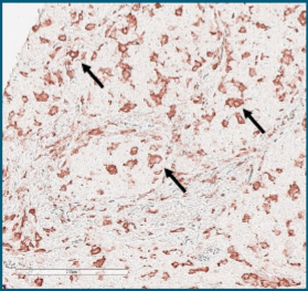 Microscopic image showing cells stained with a pink dye, with three black arrows pointing to specific cell structures.