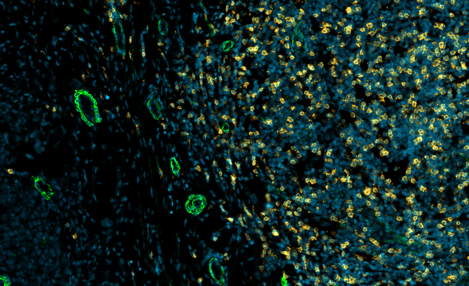 Microscopic view of cells with green and yellow fluorescent markings against a blue background.