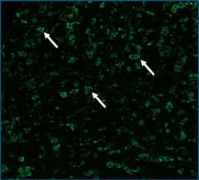 Microscopic view with three arrows pointing to small, irregularly shaped green structures against a dark background.