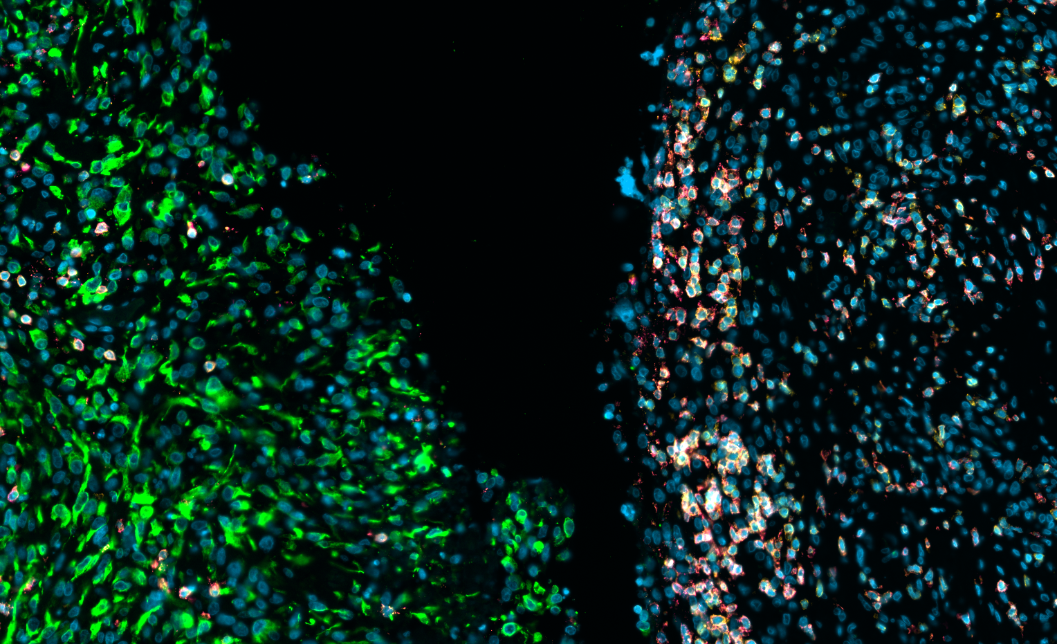 Fluorescent microscopy image showing two groups of cells, one with green fluorescent labels on the left and one with red and blue fluorescent labels on the right, against a black background.