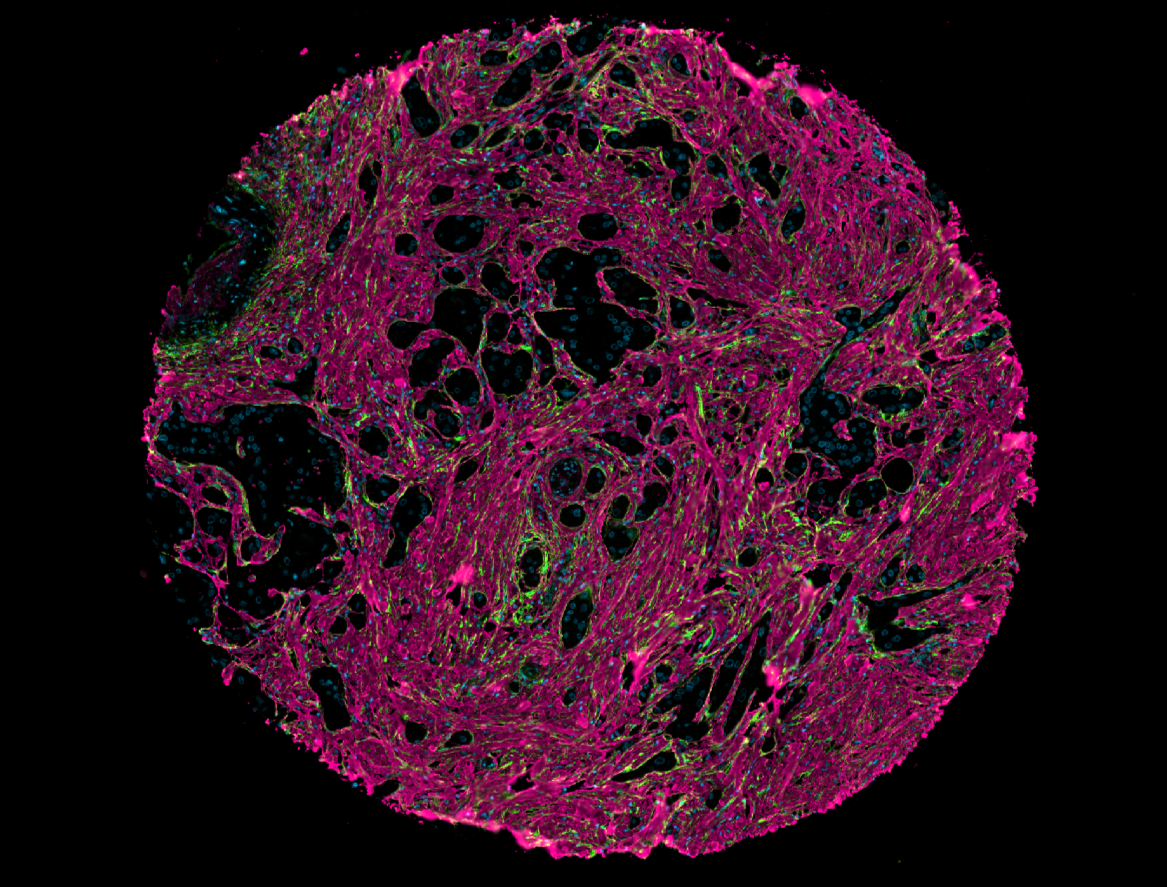 Microscopic view of a biological sample showing cellular structure with fluorescent staining, featuring pink, green, and blue colors on a black background.