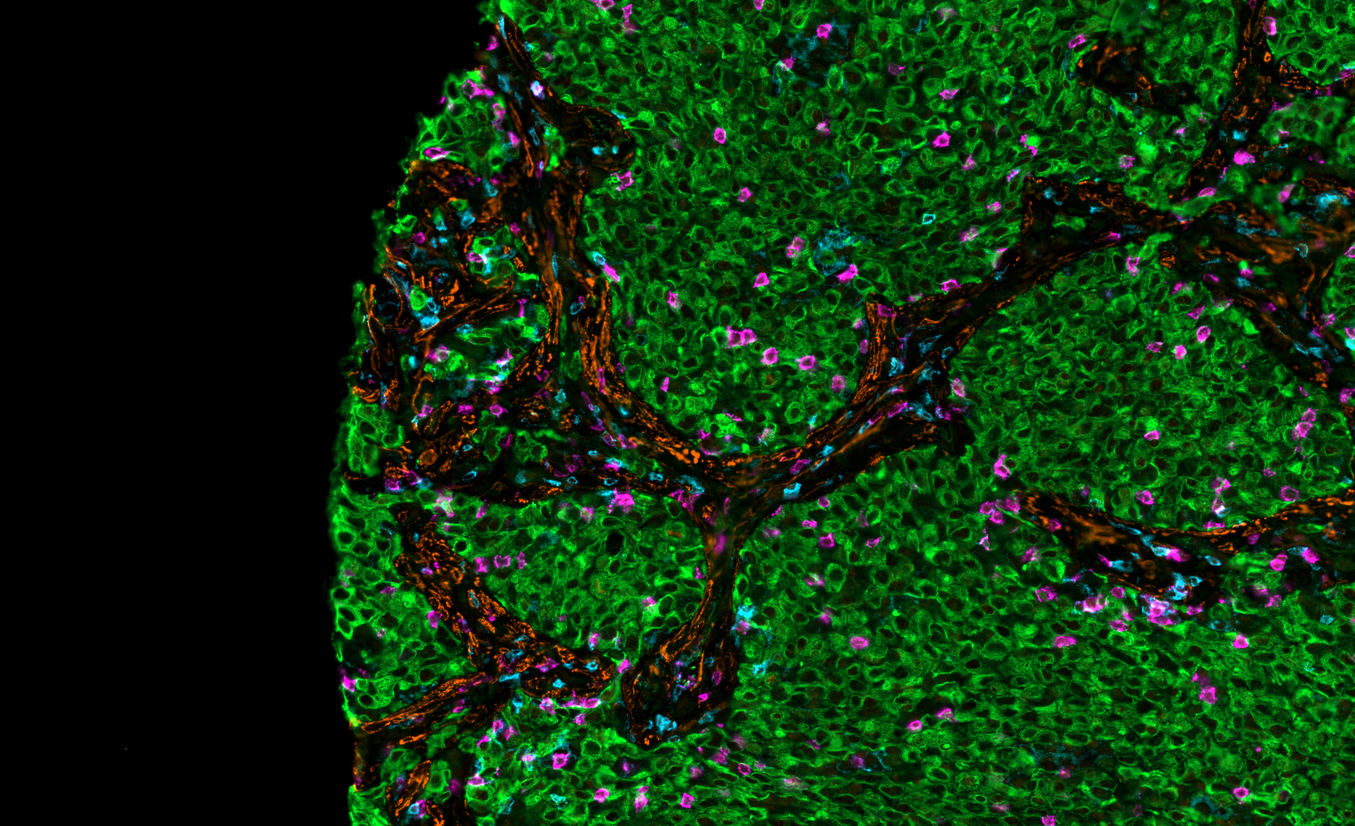 Microscopic view of a biological tissue sample with green, purple, blue, and orange colored structures.