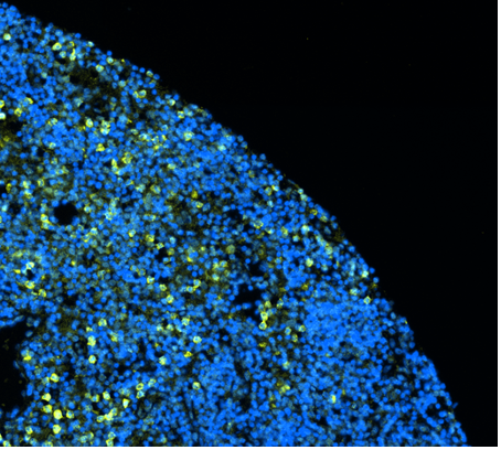 Magnified view of cells with blue and yellow fluorescent staining on a black background.