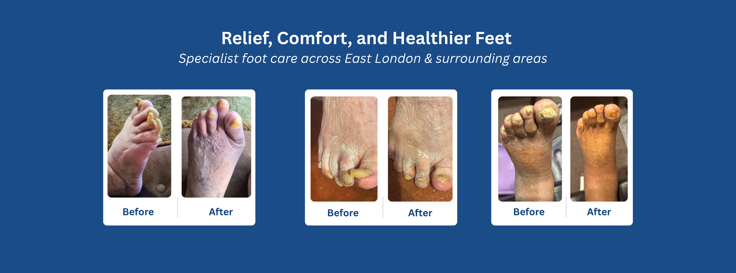 Before and after foot care results showing improvement from a mobile foot care treatment in East London