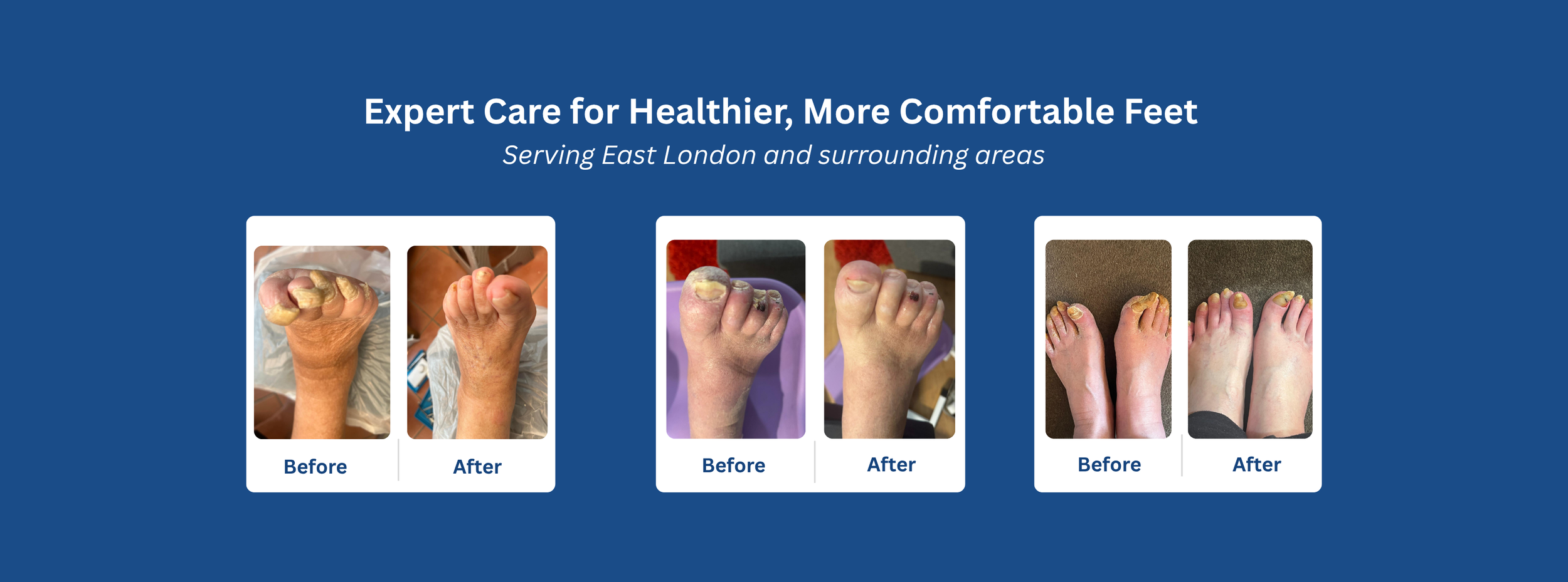 Before and after foot care results showing multiple treatments including toenail cutting and callus removal from mobile foot care services in East London