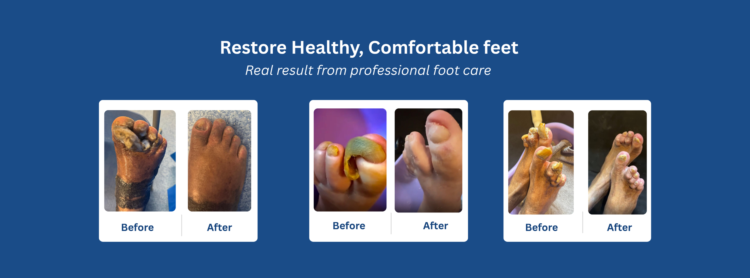 Before and after results of professional foot care treatment carried out during a home visit