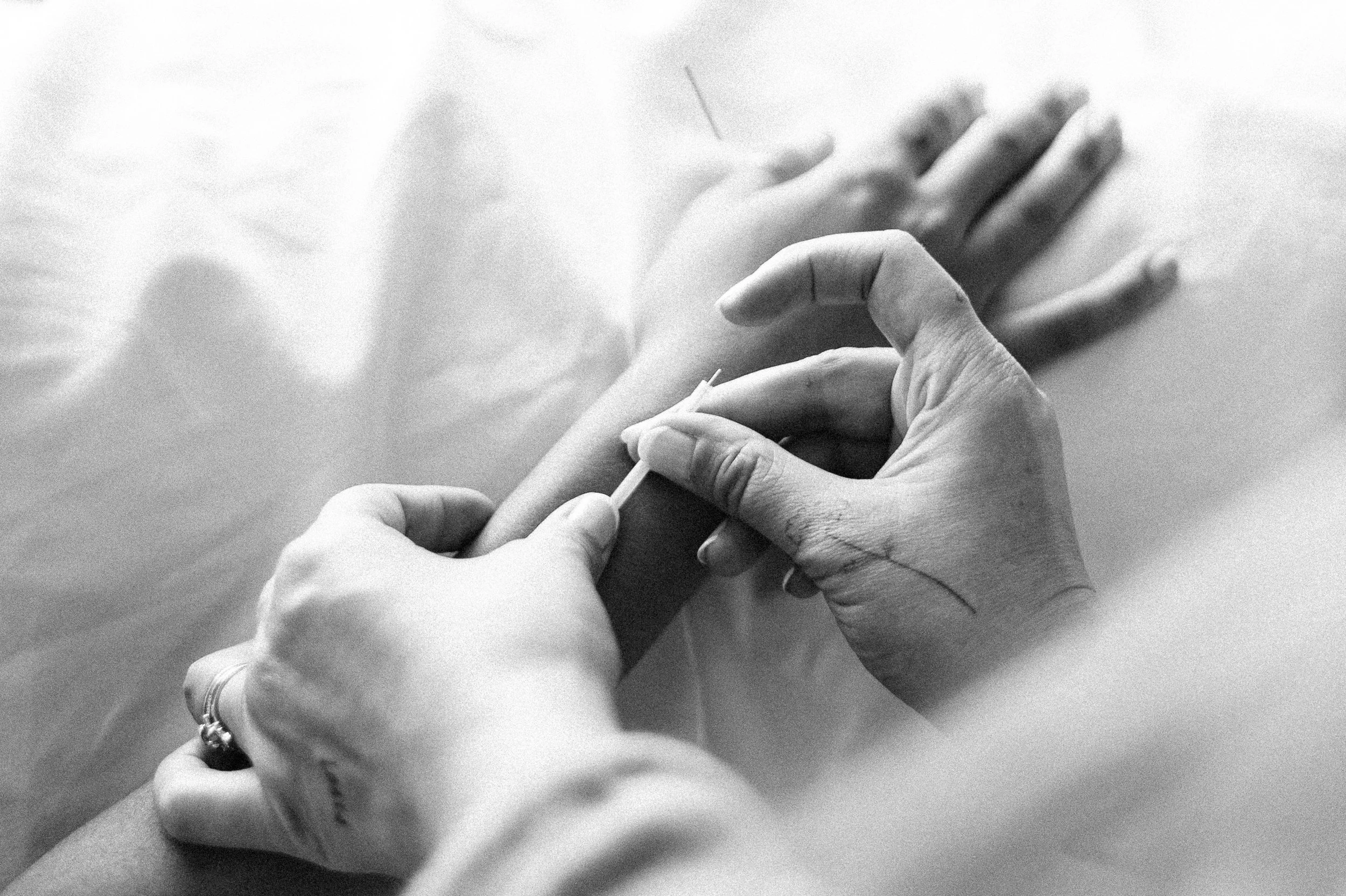 Acupuncture treatment for endometriosis support in Portland Oregon