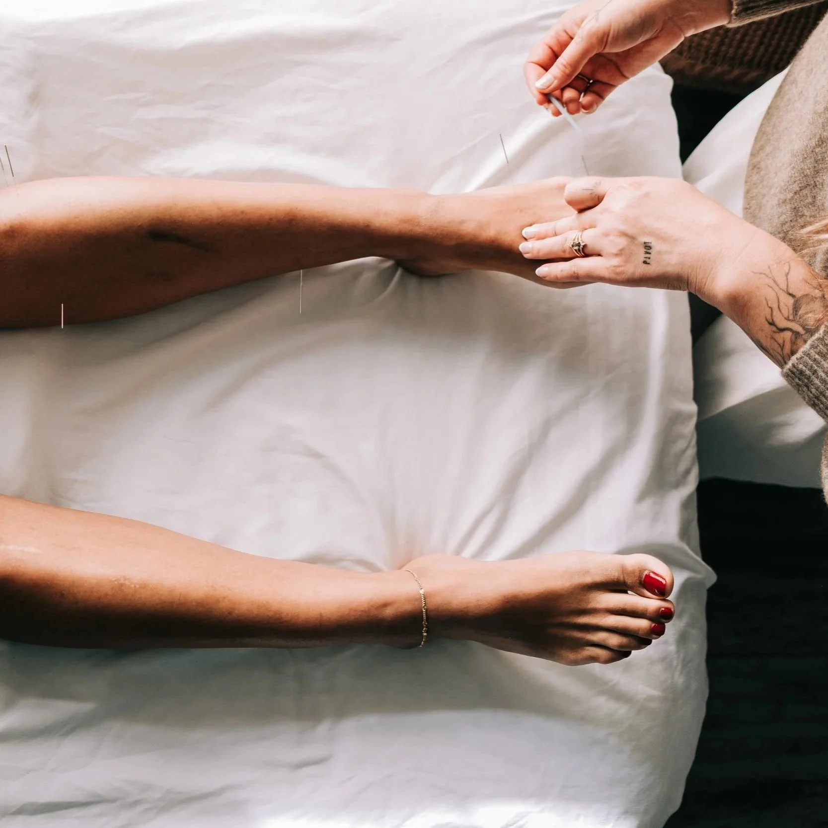Acupuncture treatment on the feet performed in a Portland Oregon acupuncture clinic