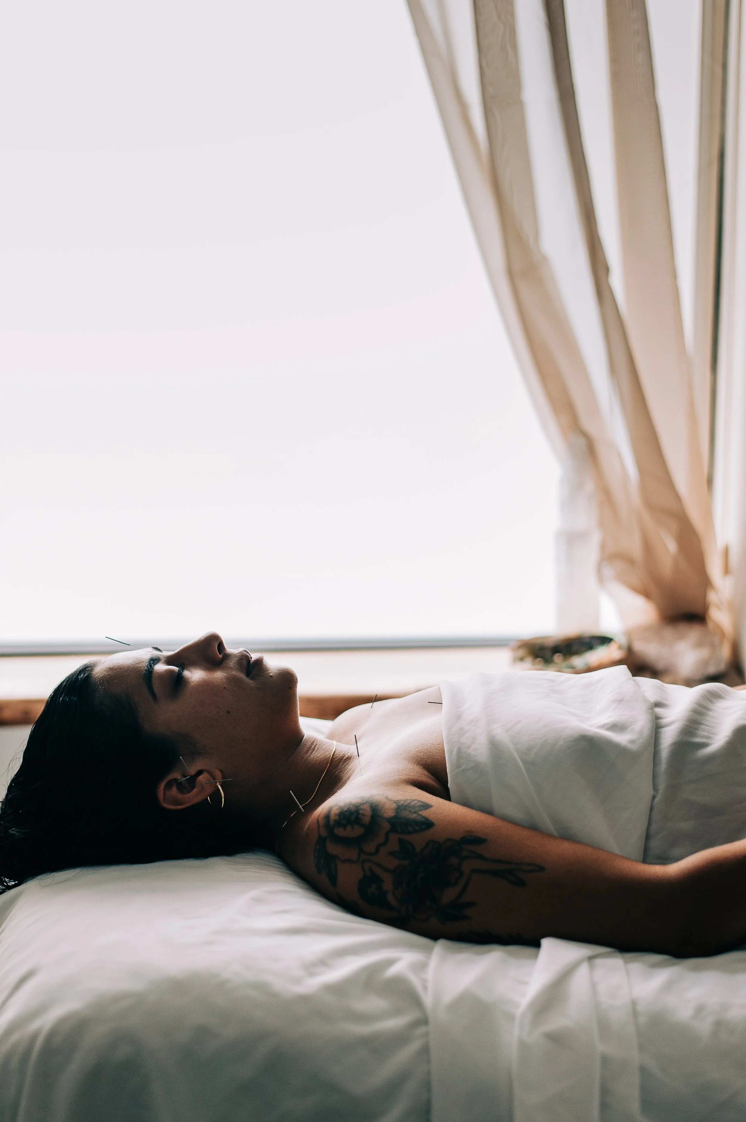 Acupuncture treatment for endometriosis support in Portland Oregon