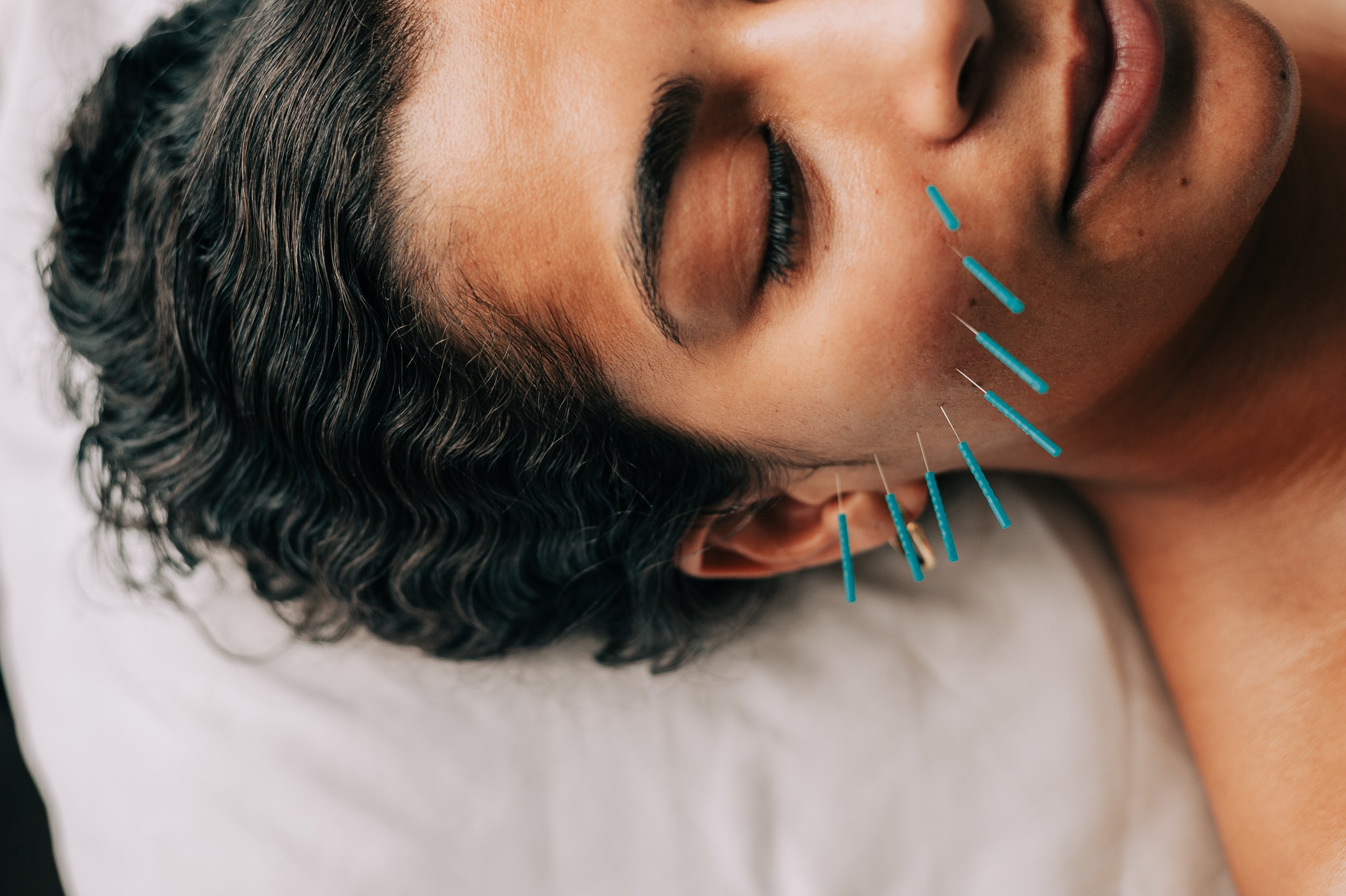 Sculpt — Cosmetic Acupuncture Facial
