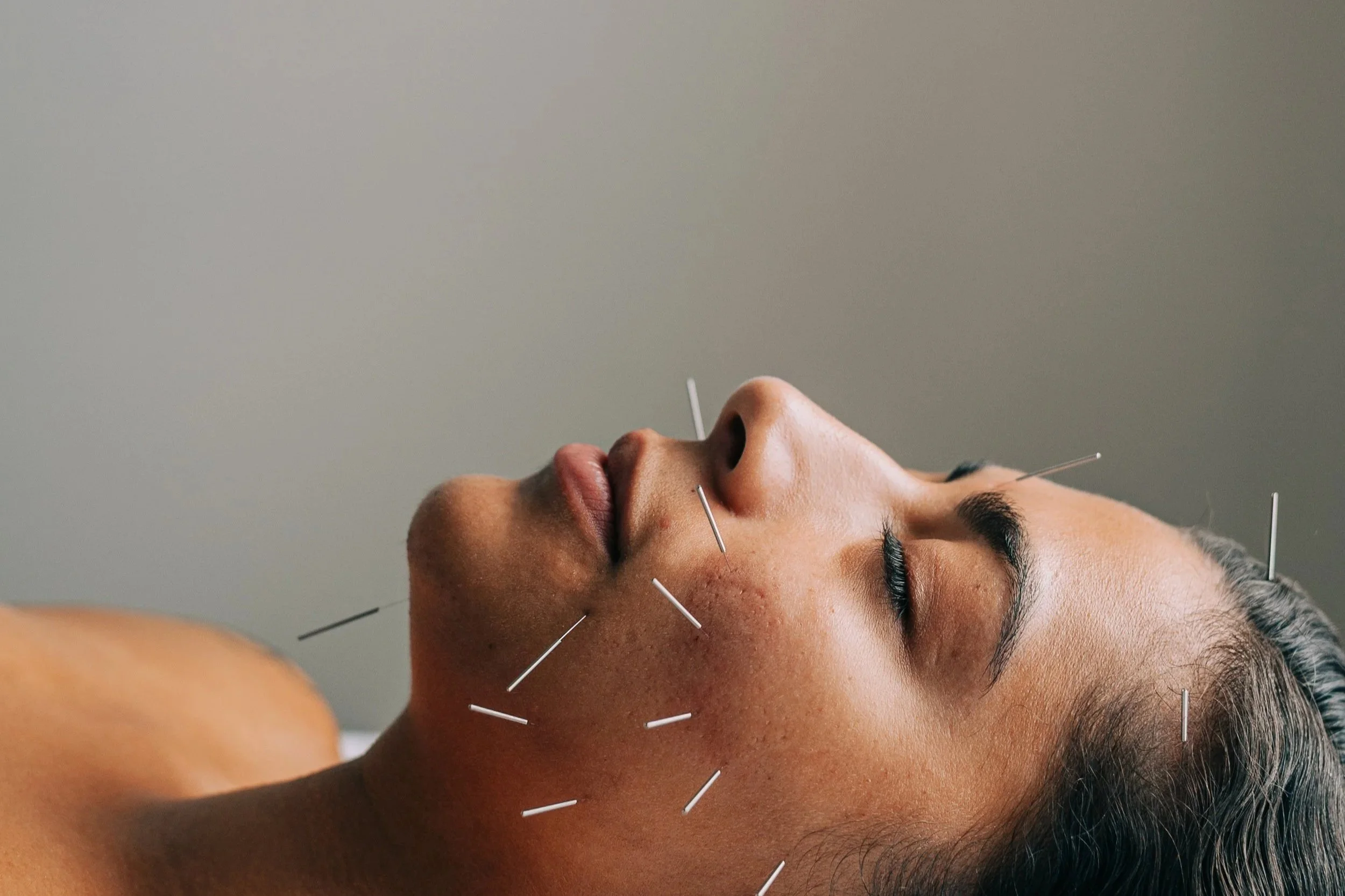 Acupuncturist providing cosmetic acupuncture and holistic skin care in Portland Oregon