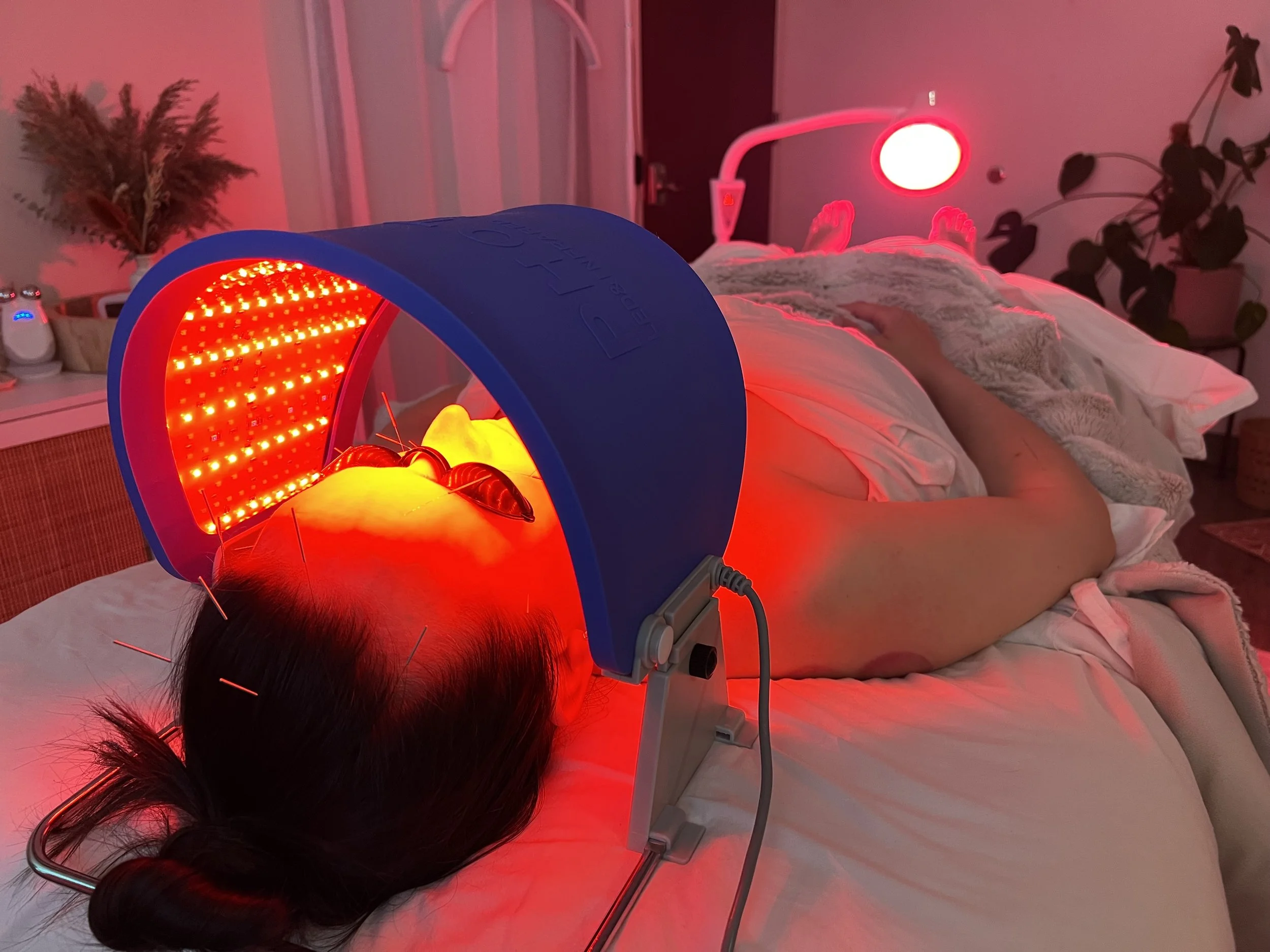 Acupuncturist providing cosmetic acupuncture and holistic skin care in Portland Oregon