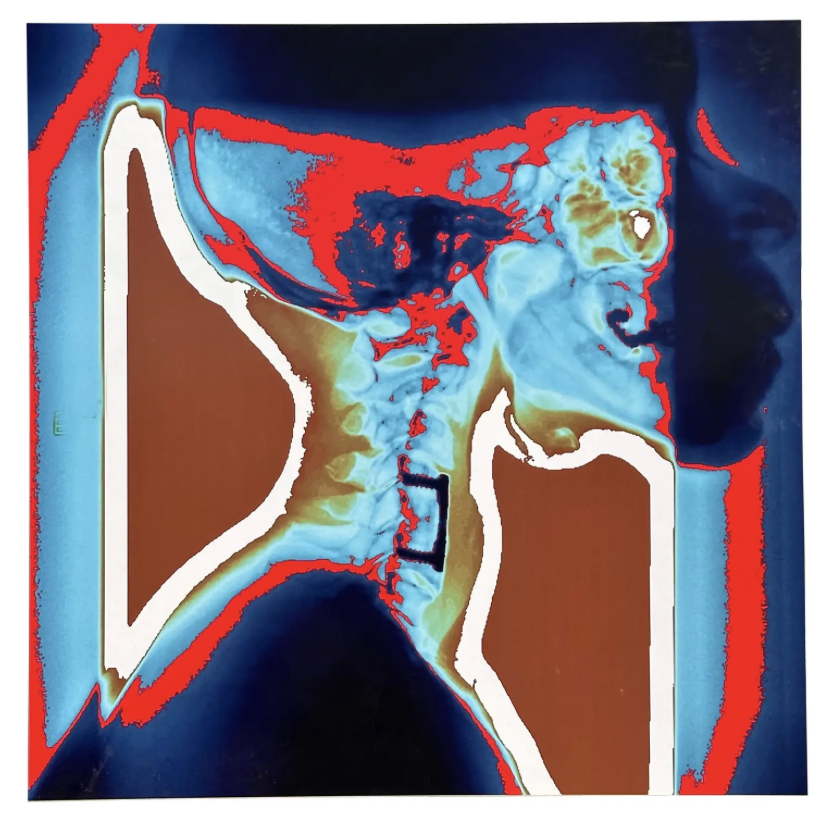 Modern Techno Skeleton Art of a Skull on Aluminum