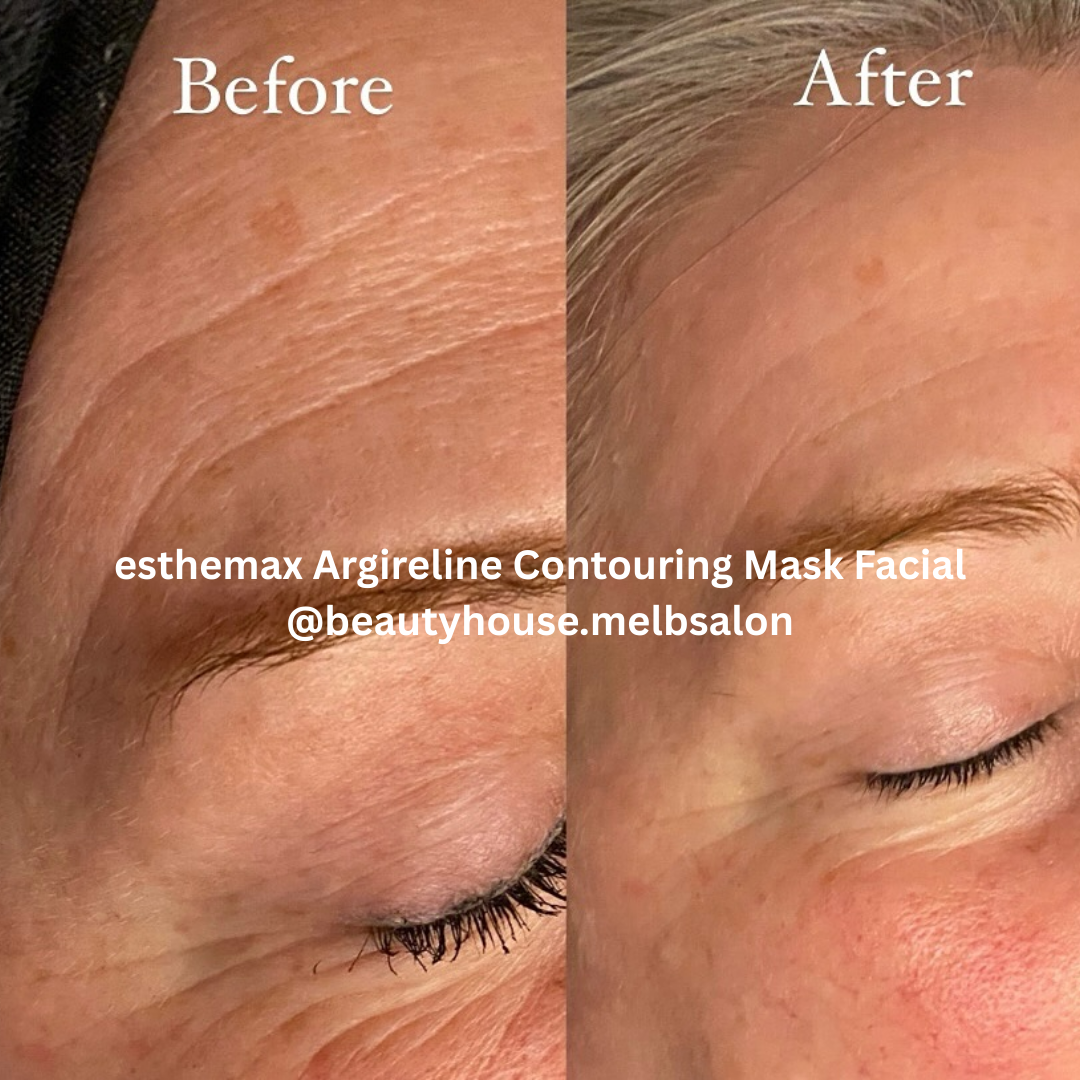 esthemax argireline contouring mask results Australia 1 .png