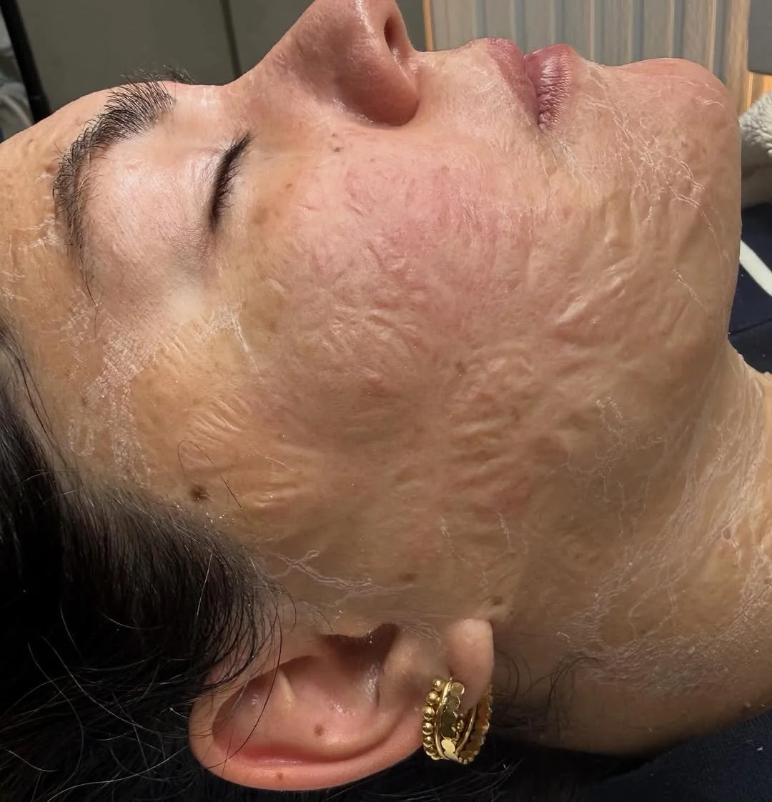 #Repost from @dermaglowstudio__ Our Lymphatic Lift Facial works from within to de-puff, contour and revitalise your skin&mdash;leaving you with a smoother, tighter and more radiant complexion 💫

Think less puffiness, more definition, and that fresh,