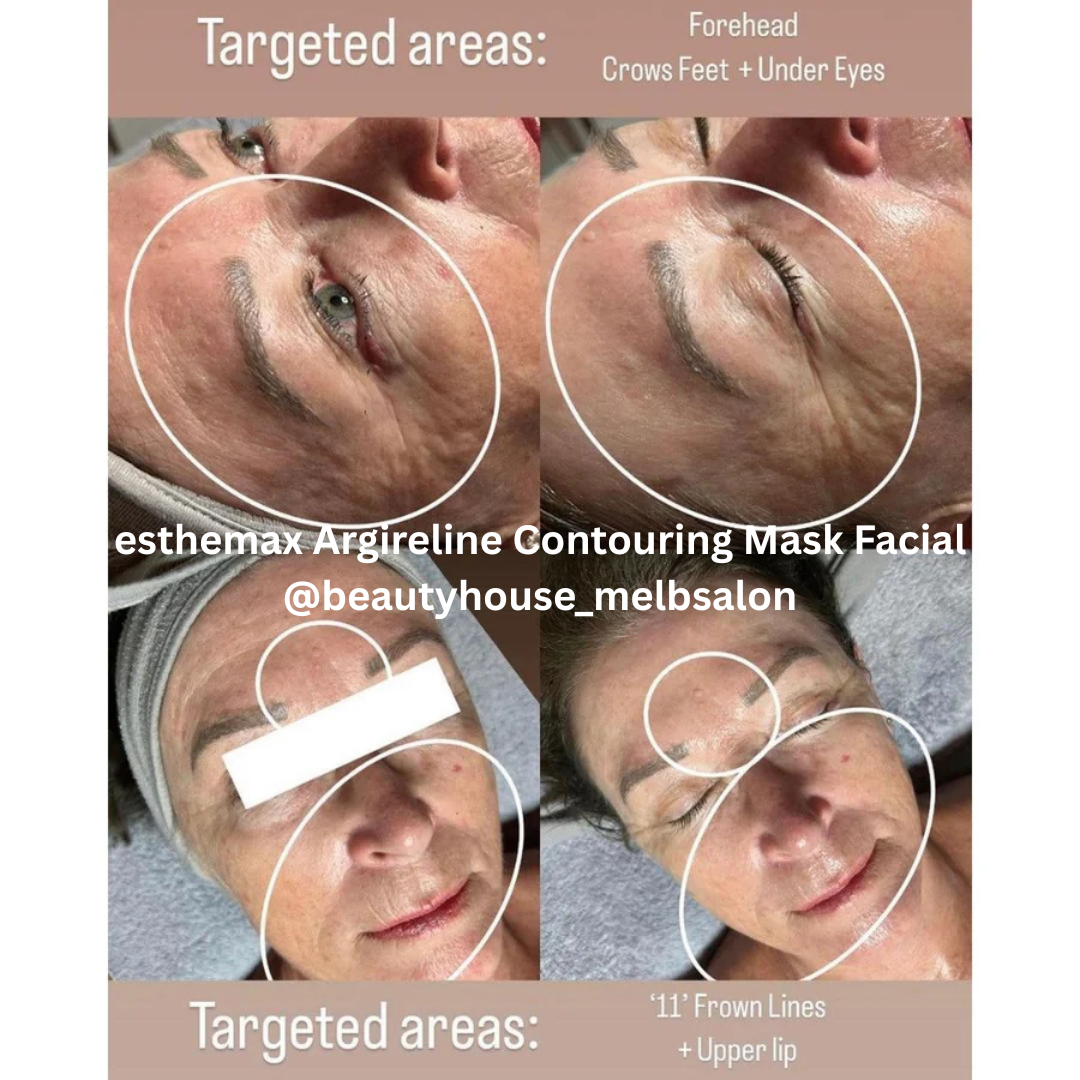 esthemax Argireline Contouring Mask Facial Beauty House Melbourne Salon .png