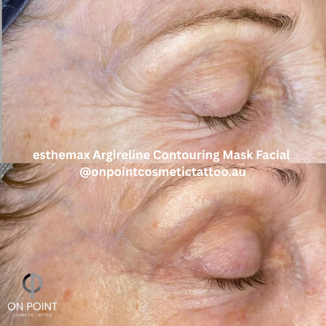 esthemax argireline contouring mask on point cosmetic tattoo .png