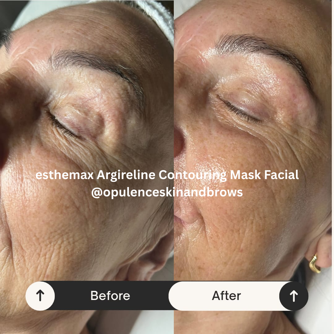 esthemax argireline contouring mask results Australia 3.png