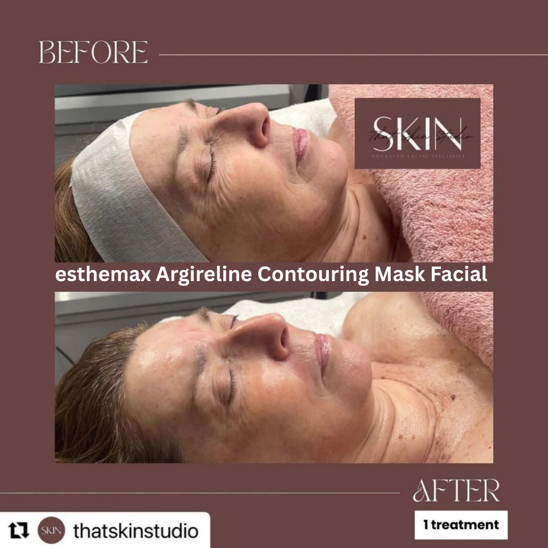 esthemax Argireline Contouring Mask Facial that skin studio.png