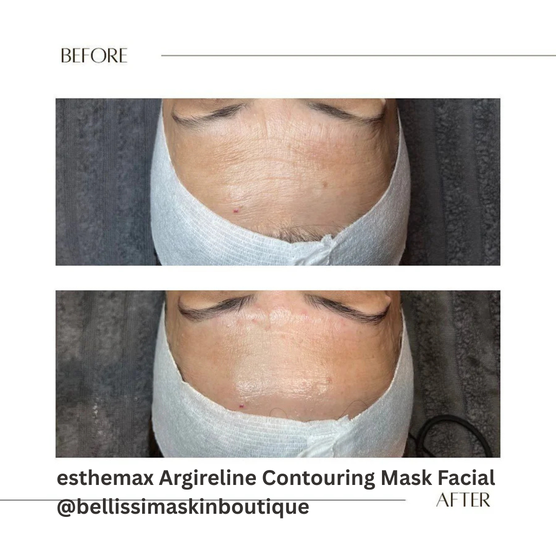 esthemax Argireline Contouring Mask Facial Bellissima Skin Boutique.png