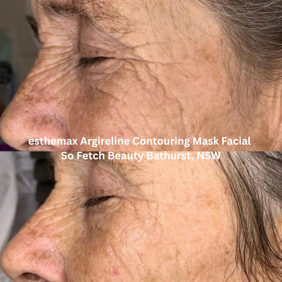 esthemax Argireline Contouring Mask Facial So fetch beauty.png
