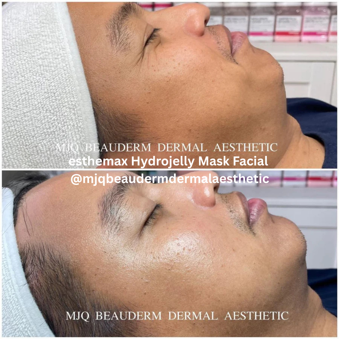 esthemax Hydrojelly Mask Facial MJQ BEAUDERM.png