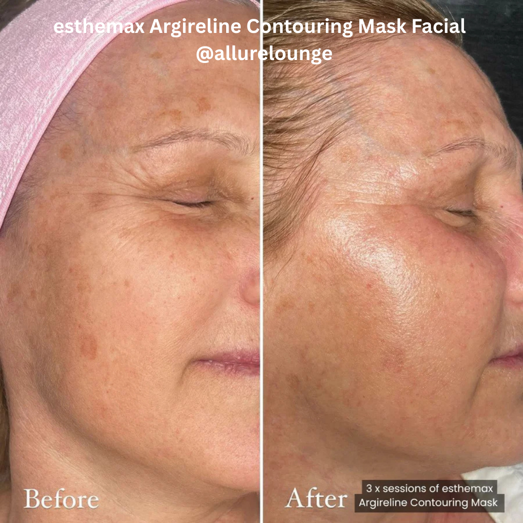 esthemax Argireline Contouring Mask Facial allure lounge.png
