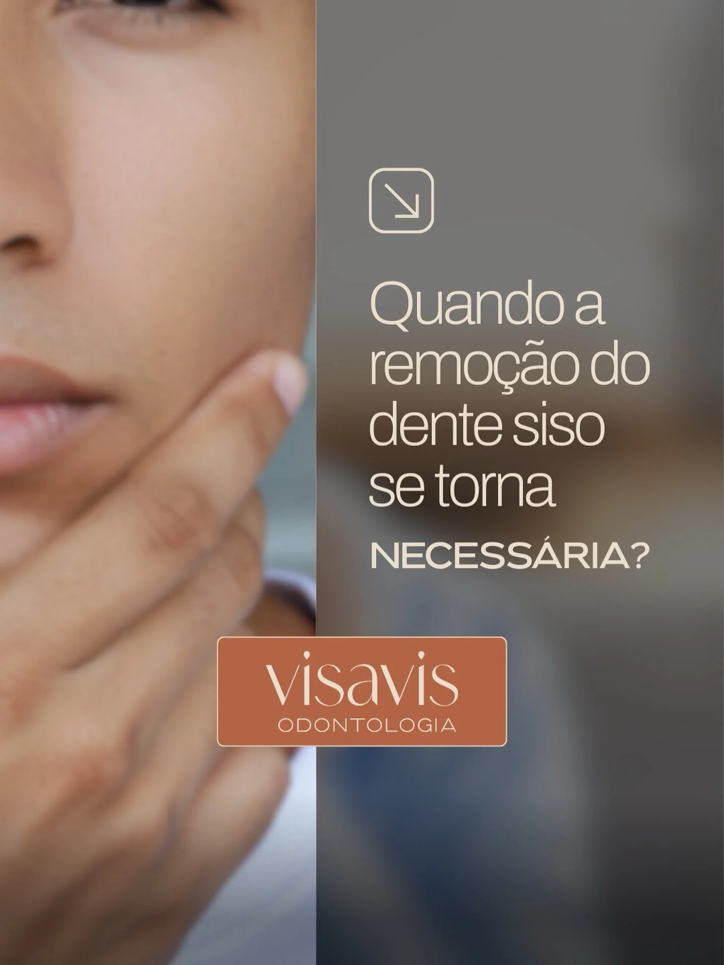 A extra&ccedil;&atilde;o do siso pode ser indicada em situa&ccedil;&otilde;es como:

✔️ Dor ou inflama&ccedil;&atilde;o frequente na regi&atilde;o

✔️ Apinhamento dent&aacute;rio ou desalinhamento dos outros dentes

✔️ C&aacute;ries ou infec&ccedil;&