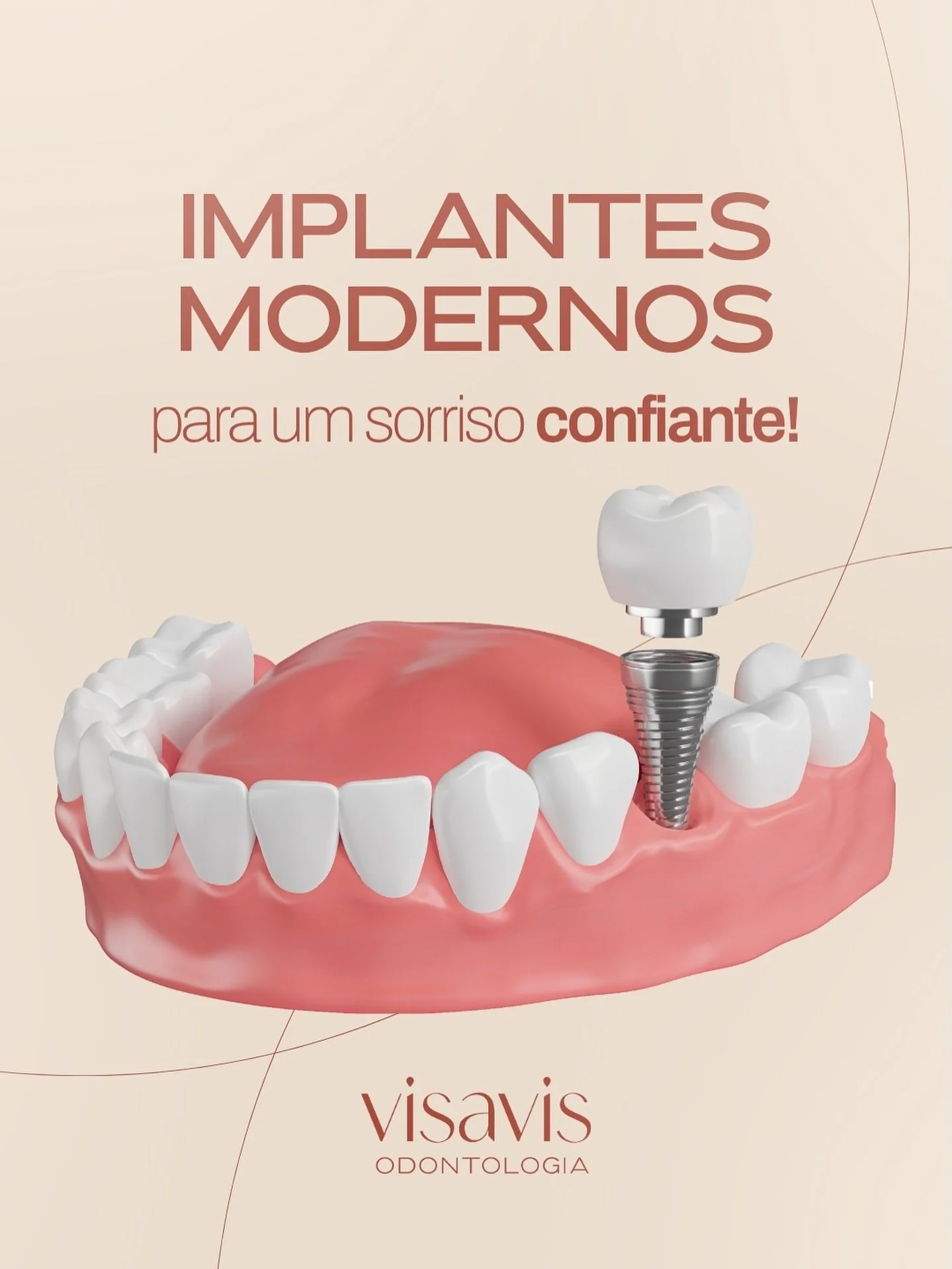 Perder um dente n&atilde;o precisa ser motivo de inseguran&ccedil;a. Com os implantes dent&aacute;rios modernos, voc&ecirc; recupera a est&eacute;tica, a fun&ccedil;&atilde;o e a confian&ccedil;a para sorrir sem medo.

Vantagens: conforto, durabilida
