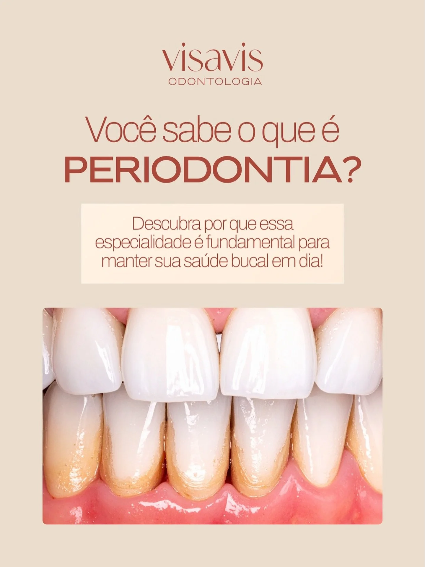 Voc&ecirc; sabe o que &eacute; Periodontia? 🤔
Ela &eacute; a especialidade respons&aacute;vel por cuidar da gengiva e do osso que sustentam os dentes, a base de um sorriso saud&aacute;vel! 

Quando esses tecidos s&atilde;o afetados, podem surgir pro