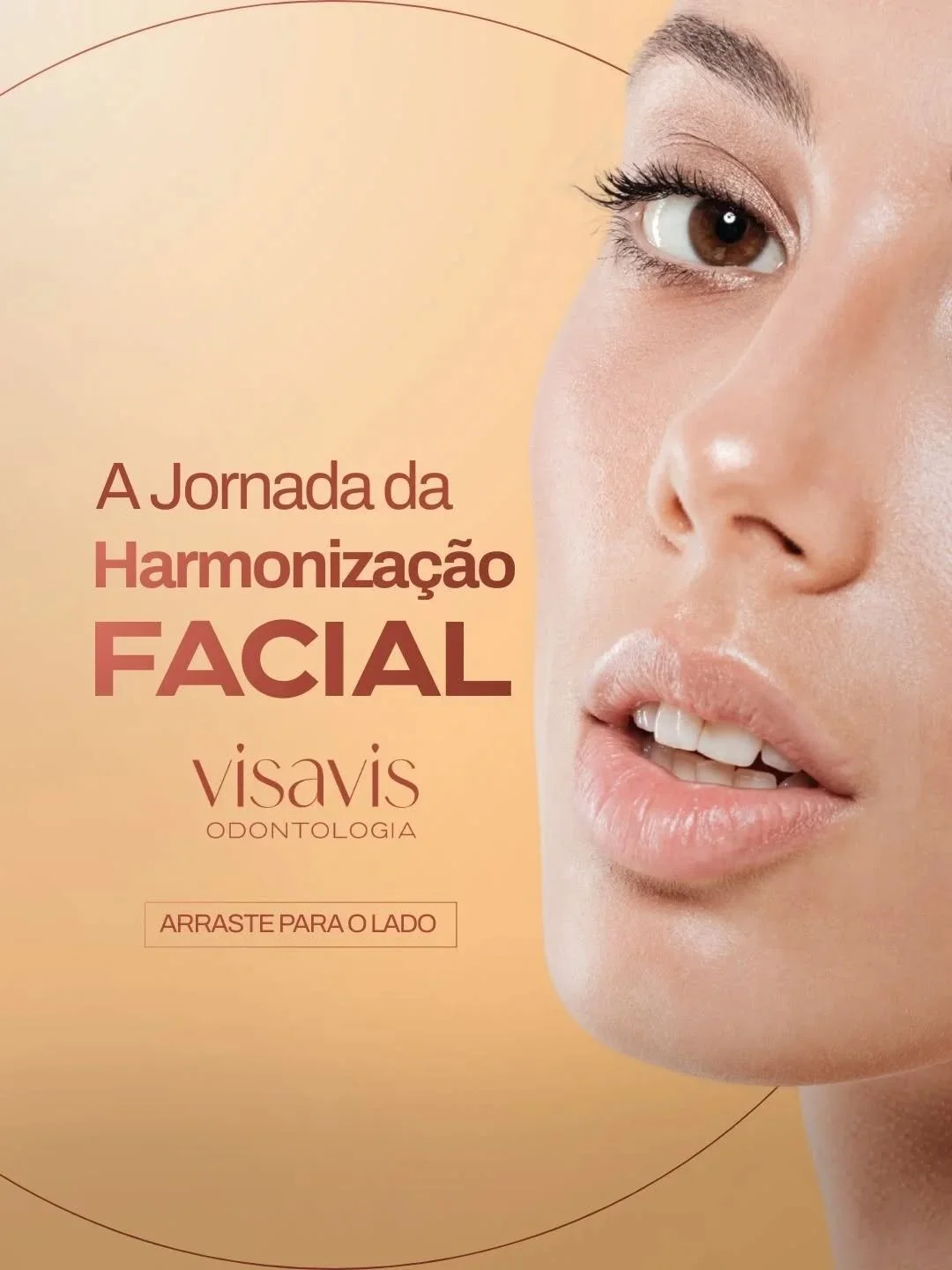 Harmoniza&ccedil;&atilde;o facial n&atilde;o &eacute; sobre transformar quem voc&ecirc; &eacute;.
&Eacute; sobre equilibrar propor&ccedil;&otilde;es e valorizar o que j&aacute; &eacute; bonito.
Ap&oacute;s tratamentos dent&aacute;rios, pequenos ajust